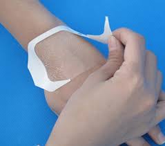 transparent IV dressing